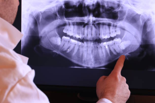Best Emergency Gum Treatment in Susitna North, AK